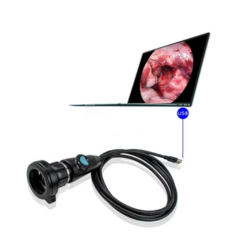 רפואי, אף אוזן גרון HD 1080P אנדוסקופיה יחידת נייד USB3.0 אנדוסקופ עבור מחשב נייד